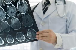 Androcur : 112 000 courriers envoyés pour alerter les patients du risque de tumeur cérébrale