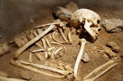 Syphilis : des ossements vieux de 2.000 ans nous éclairent sur ses origines