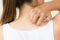 Des coiffeurs alertent sur des allergies aux teintures après avoir attrapé la Covid-19