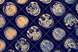 Big Data : l’inflammation aggrave le risque de Parkinson et sa réduction le réduit