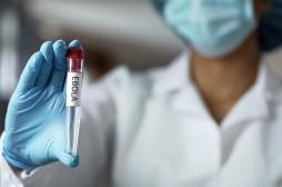 Ebola : l'anticorps d'un survivant pourrait permettre de créer un vaccin universel