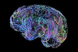 Une carte des émotions pour réconcilier les médecines