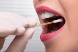 Cancer de la bouche : bientôt un dépistage salivaire en une heure ?