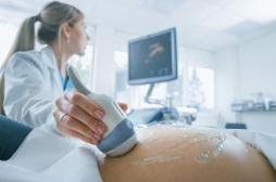 Grossesse : une échographie à 36 semaines permettrait d'anticiper certains risques liés à l'accouchement