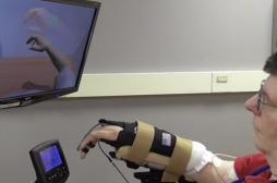 Un tétraplégique peut  bouger son bras grâce à une neuroprothèse