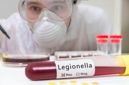 Une toxine capable de freiner l'infection à Legionella