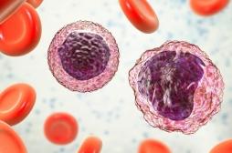 Cancer du sang : un gène identifié comme oncogène dans le lymphome B