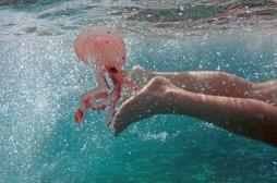 Méduses, poissons venimeux : les mauvaises rencontres de la baignade