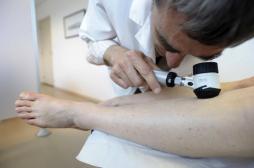 Cancer de la peau : la journée de dépistage pour les personnes à risques