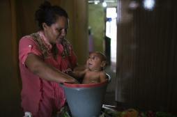 Grossesse : Zika multiplie par 50 le risque de microcéphalie