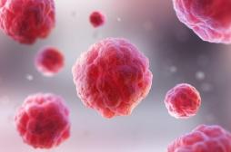 Démence : utiliser l’autophagie des cellules pour créer de nouveaux traitements 