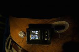 Diabète : le pancréas artificiel confirme son efficacité