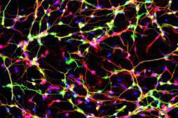 Parkinson : réparer les neurones avec des cellules de peau