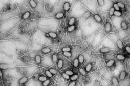 Antibiorésistance : sauvé d'une amputation grâce à la phagothérapie