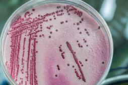 Antibiorésistance : 3 salmonelles sur 10 concernées en Europe