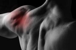 Douleur de l’épaule : bénéfice trop modeste de la chirurgie