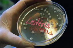 Listeria : plusieurs lots de fromages contaminés dans la Loire 