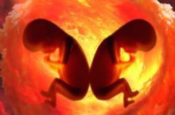 Jumeaux : un père biologique est aussi l'oncle de son fils 