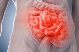 Le risque de maladies inflammatoires de l'intestin augmenté par certains anti-diabétiques
