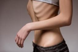 Hormone du bien-être : basse en cas d'anorexie ou d'obésité