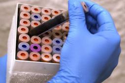 Cancers de la tête et du cou : bientôt détectés dans la salive et le sang