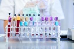 Cancer : les chercheurs mettent au point un test ADN capable de le détecter en dix minutes