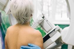 L'inquiétant recul des mammographies à cause de la pandémie 