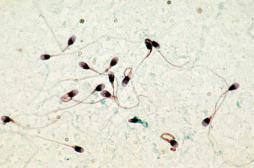 Pesticides : craintes sur le sperme des ados exposés