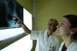 Immunothérapie : une révolution dans les cancers du poumon 