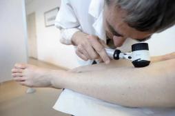 Mélanome avancé : des résultats positifs pour les patients