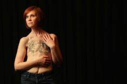 Cancer du sein : la difficile guérison psychologique après une mastectomie