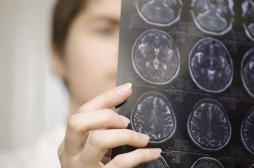 Alzheimer : les premiers signes 18 ans avant le diagnostic