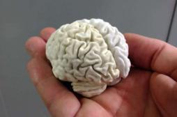 Parkinson : un dispositif de neurostimulation implantable approuvé 