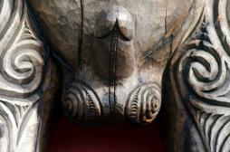 Greffe de pénis : 60 jeunes soldats américains pourraient en bénéficier