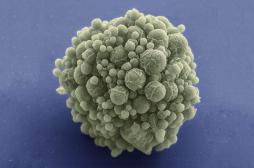 Craig Venter a créé un organisme vivant avec 473 gènes