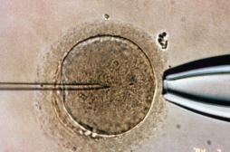Donneur de sperme : un droit à l'anonymat et un devoir moral