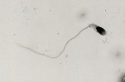 Des chercheurs français auraient conçu des spermatozoïdes in vitro