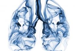 Cancer du poumon : le dépistage par le risque individuel supérieur au scanner du poumon