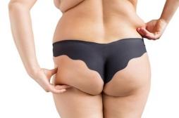 6% des cancers sont liés au surpoids et au diabète, surtout chez les femmes