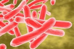 Tuberculose pulmonaire : un étudiant infecté peut contaminer 10 à 15 personnes