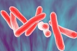 Smarves, Châtelleraudais : plusieurs cas de tuberculose. Ce qu'il faut savoir