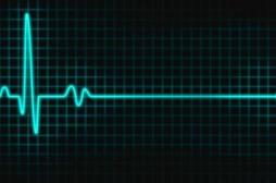 Que se passe-t-il dans le cerveau au moment de la mort ?