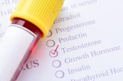 Cancer de la prostate : la testostérone diminue le risque de rechute