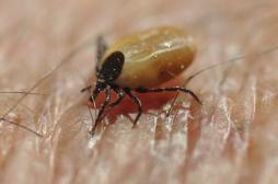 Maladie de Lyme : des anti-inflammatoires pour limiter les complications