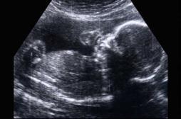 Dépakine : le parquet de Paris ouvre une enquête