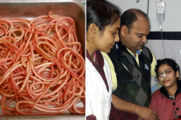 Inde : des médecins retirent 150 vers de l'intestin d’une femme
