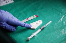 VIH : la Grande Bretagne teste un nouveau traitement définitif