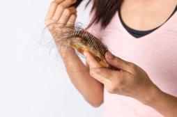 Perte de cheveux : un médicament contre l'alopécie autorisé