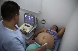 Zika : le risque de microcéphalie est faible en fin de grossesse