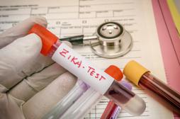 Zika : le virus se concentre dans le placenta